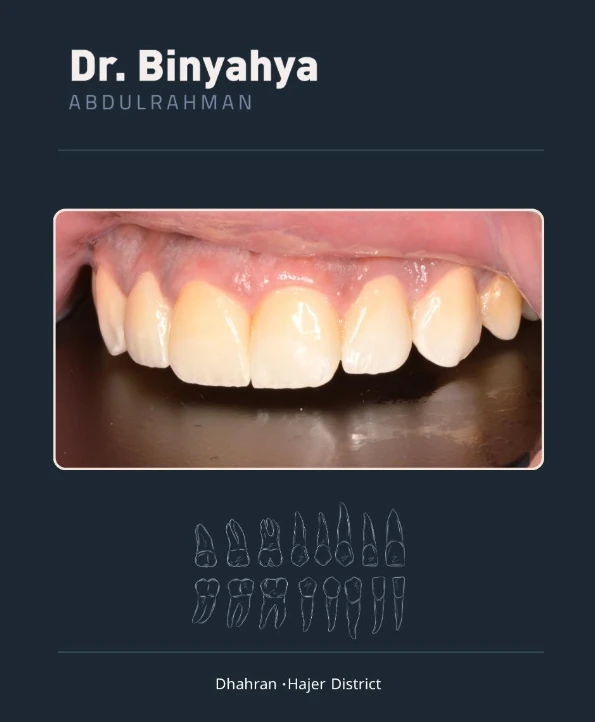 A photo of the clinic's work on upper front teeth — results differ from person to person